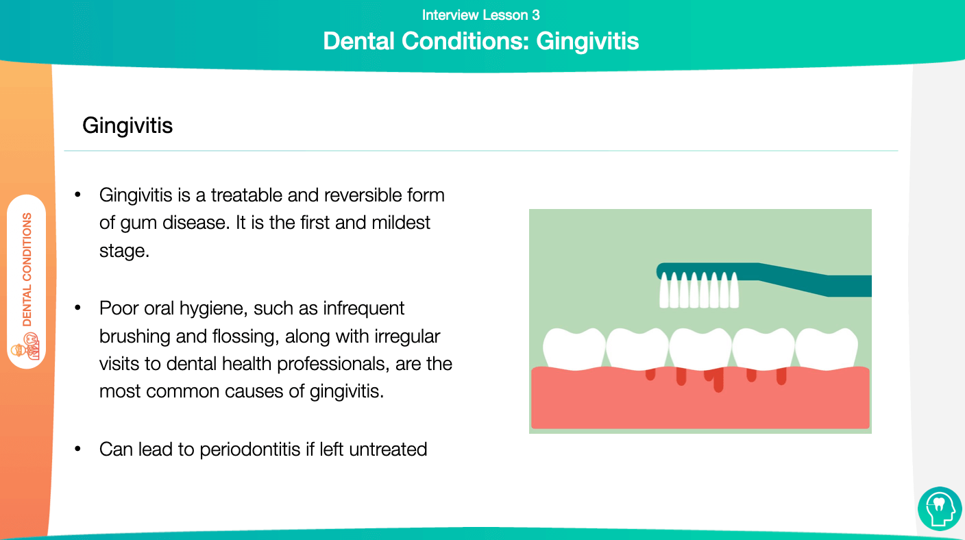 Gum Disease and Periodontitis