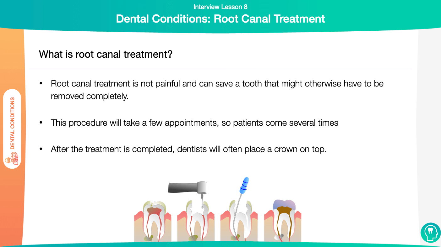 Crowns and Root Canal Treatment